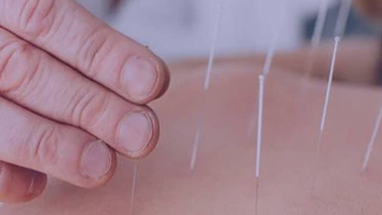 Facial