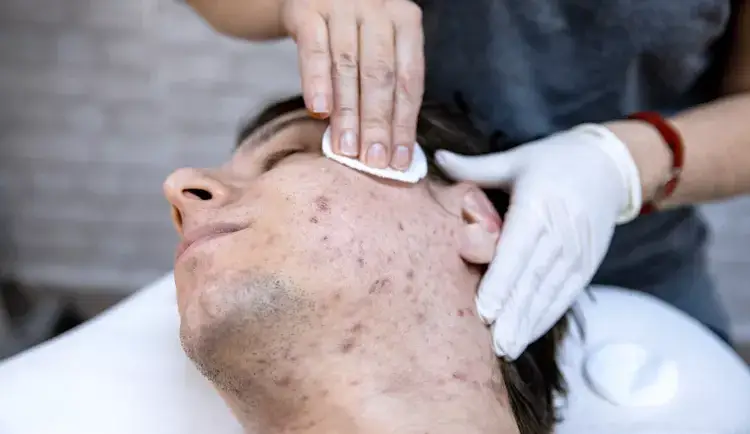 Moon Lake Spa - Massage near Vienna, Facial, Acupuncture, VIENNA VA