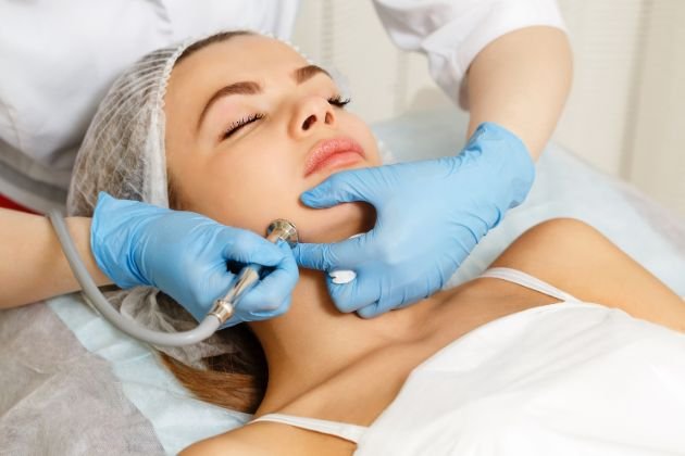 microdermabrasion vienna va