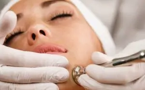 microdermabrasion