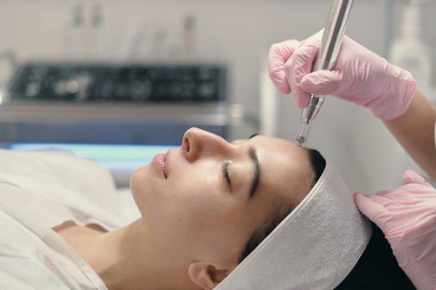 microdermabrasion in reston va